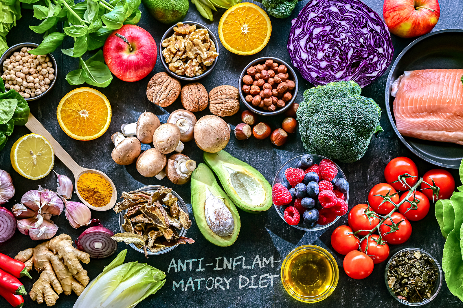 foods that naturally reduce inflammation